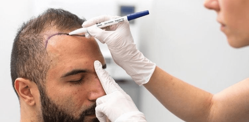 Konak Saç Ekim Merkezi