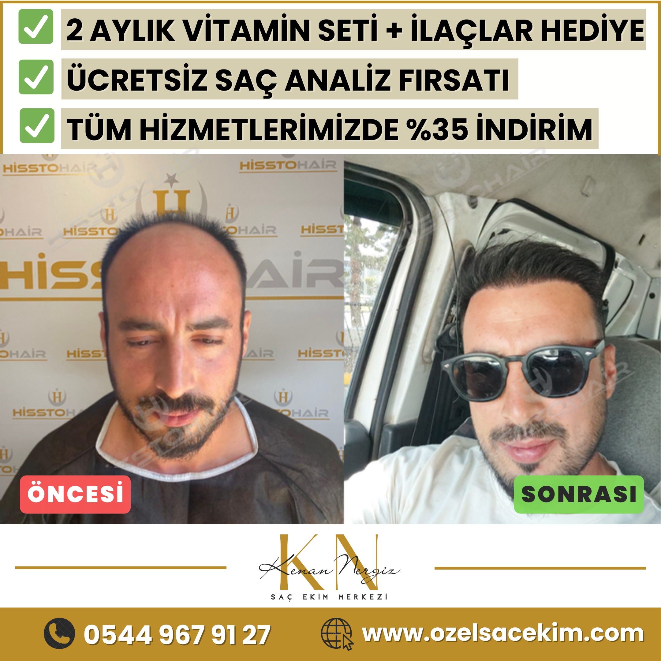 Konak Saç Ekim Merkezi