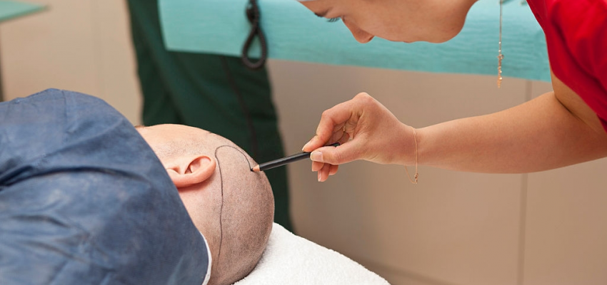 İzmir Aliağa Saç Ekim Fiyatları