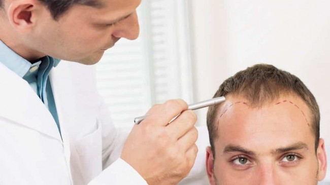 İzmir Aliağa Saç Ekim Fiyatları